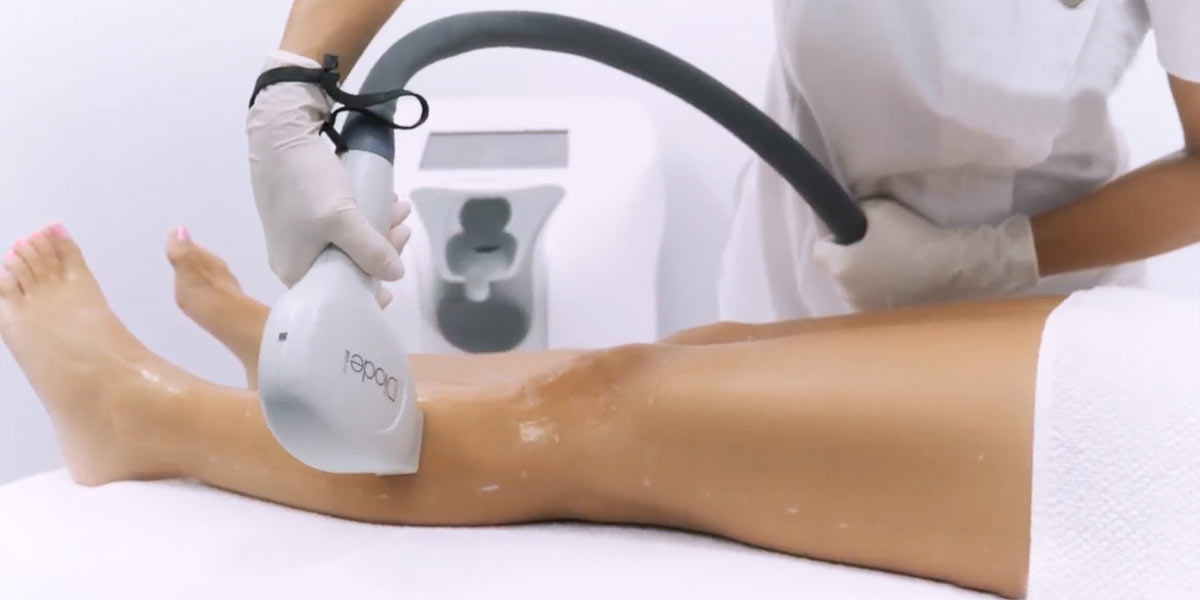 Elysion Laser Hair Removal Technology – Sheffield Laser Hair Removal